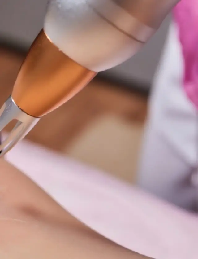 Laser-Tattoo-Removal-in-Mumbai